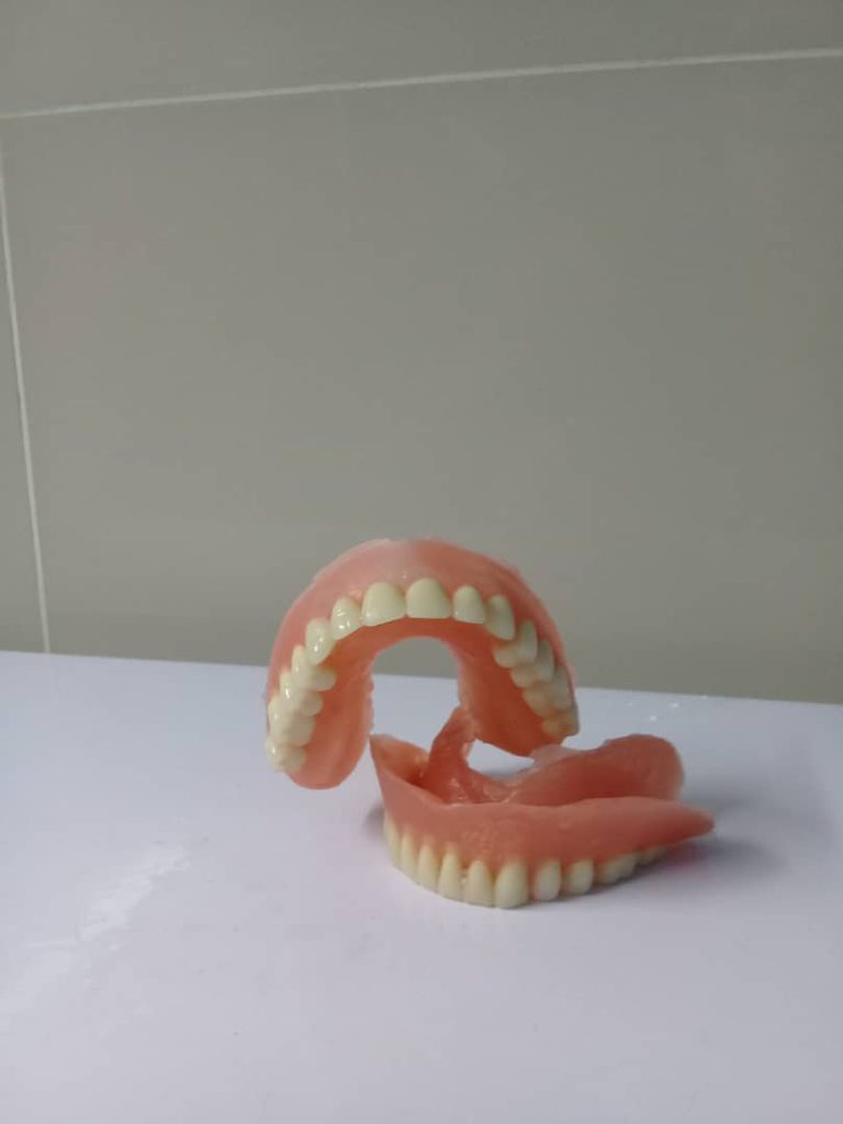 انواع دندان مصنوعی تکه ای در کرج